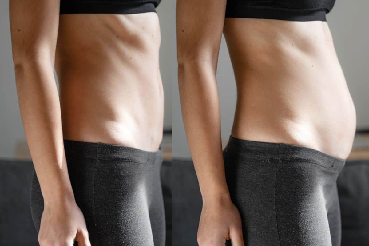 How long does diastasis recti take to improve Cricklewood?