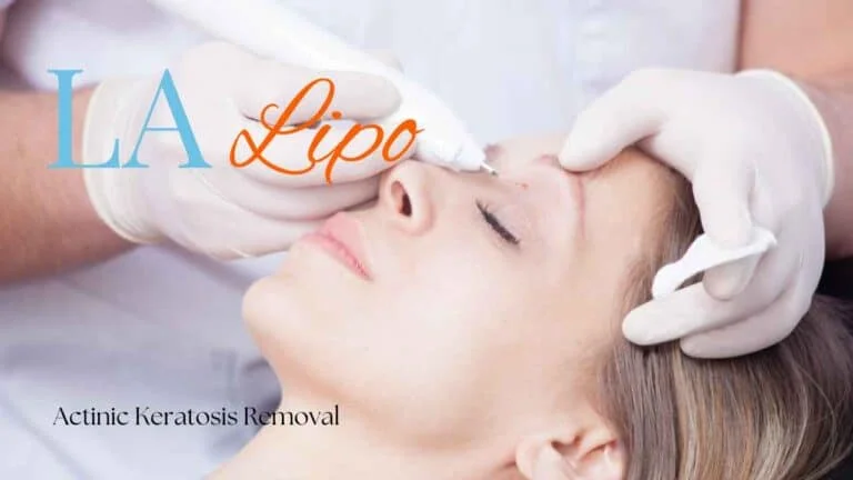 Woman receiving Actinic Keratosis Removal Treatment Cricklewood