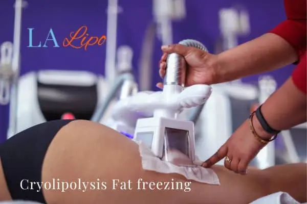 women getting fat freezing Cricklewood