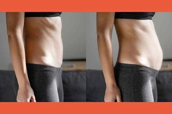 LA-EMS Body Sculpting results Cricklewood